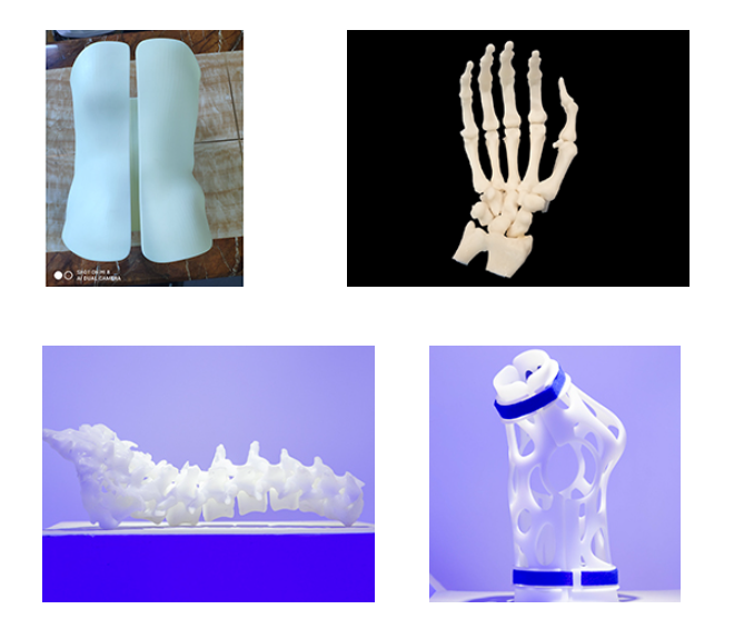 An Introduction to the Future of 3D Printed Medical Devices